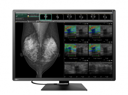 Οθόνη Μαστογραφίας, Mammography monitor