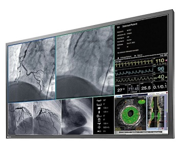 Το Νέο Ιατρικό Large-Screen UHD Monitor της EIZO για Υβριδικές Χειρουργικές Εφαρμογές: RadiForce LL580W